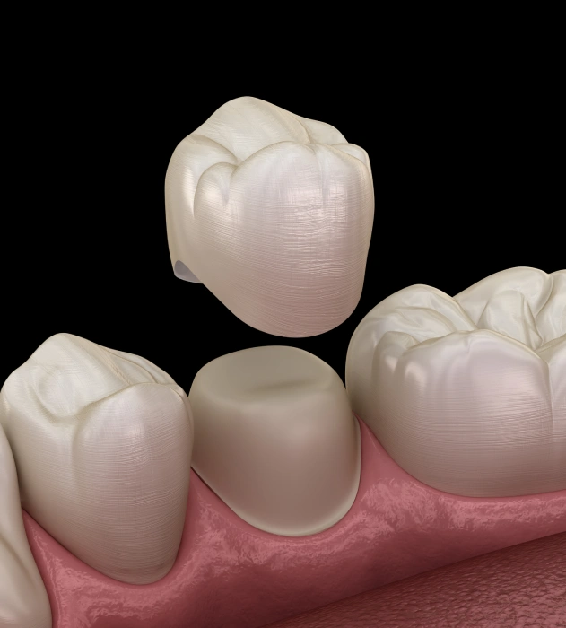 Patient receiving dental crown treatment